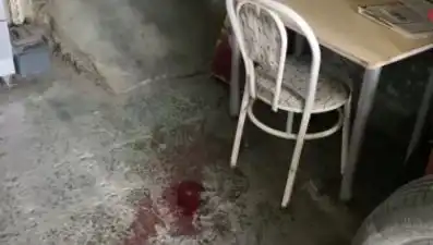 Sandalyeden Düşen Adamın Korkunç Kazası Başına Gelmeyen Kalmadı