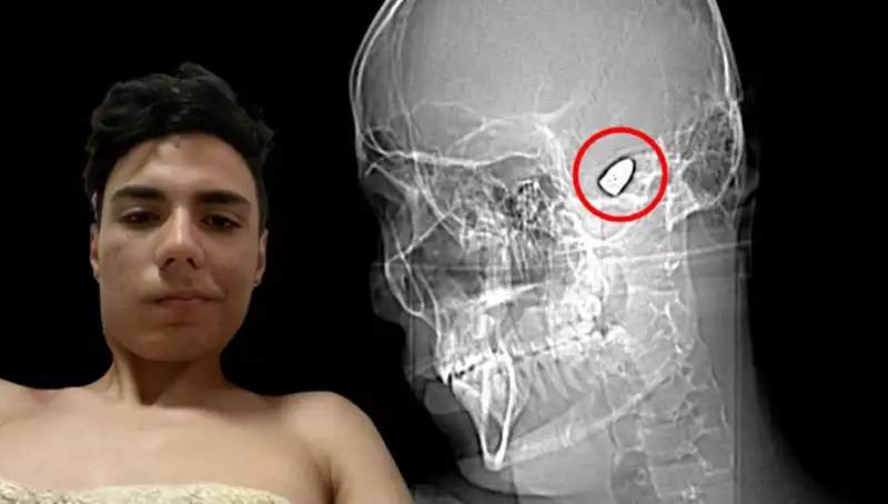 Kafasında Patlamaya Hazır Bomba Taşıyan Genç Kadının Hikayesi