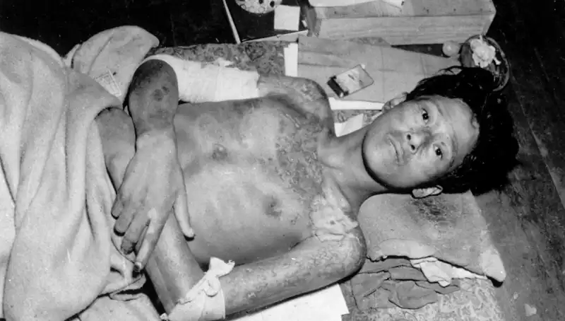 80 Yıl Sonra Nagasaki’den Gelen Alarm: Nükleer Felaket Riski Yükseliyor