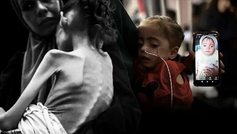Küçük Meryem’in Açlıkla Mücadele Hikayesi: 25 Kilodan 10 Kiloya Düştü