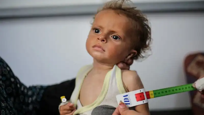 İngiltere, 300 Gazzeli Çocuğa Şartlı Nezaretle Kapılarını Açıyor
